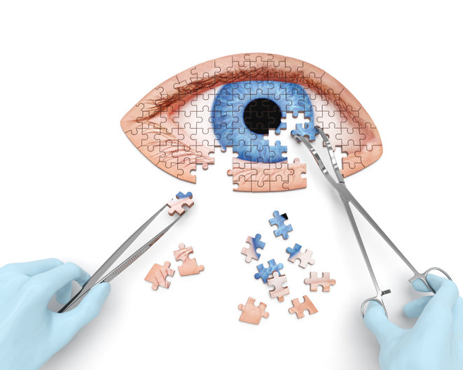 Patients who have cataract surgery reduce likelihood of developing dementia