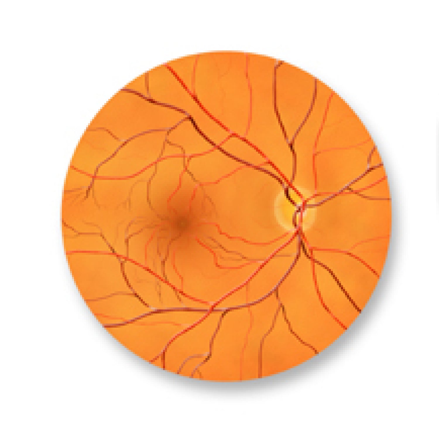 About Macular Degeneration