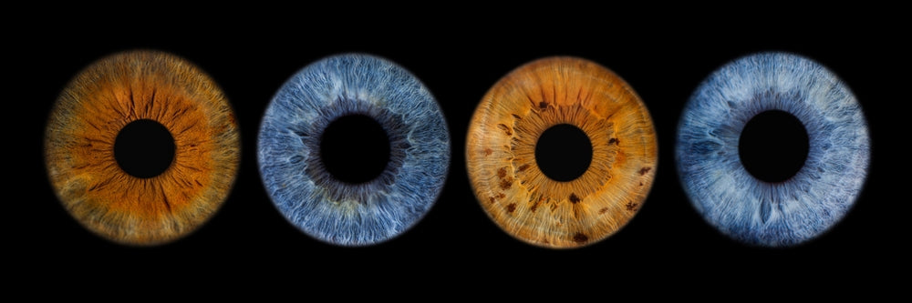 Eye color may play a role in cataract development